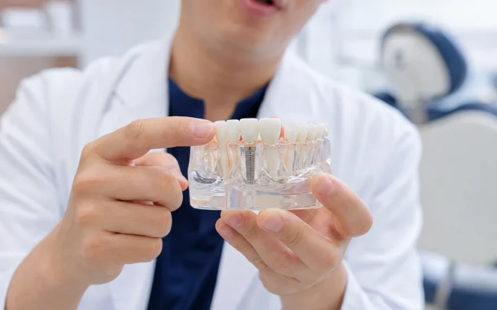 앞니 임플란트 뼈이식