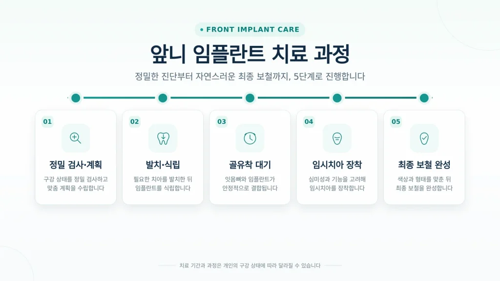 앞니 임플란트 치료 과정 5단계 타임라인